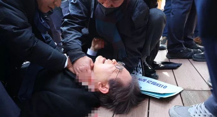 ‘피습’ 이재명, 혈관재건술 받아…”2시간 수술, 중환자실서 회복”