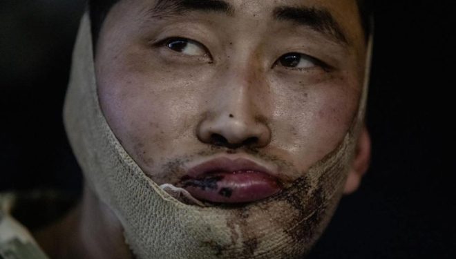 “우크라전 북한군 포로 한국행, ‘연쇄 망명’ 초래 가능성”