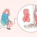 [100세건강] 퉁퉁 붓고 쥐 나는 ‘이 병’…”직립 보행 필연적 결과”