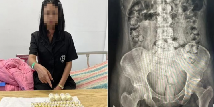 ‘콘돔으로 감싸 ‘거기’ 삽입’…4억원대 마약 밀반입 시도한 여성 2인조