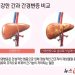 [100세건강] “70% 망가져도 모른다”…간경변증이 보내는 경고