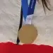 ‘불량 메달’ 논란에 이탈리아 조폐 당국 “신속한 AS 시작”